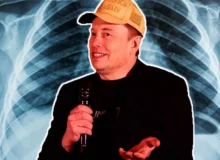 ایلان ماسک: هوش مصنوعی پلتفرم ایکس می‌تواند جزئیات تصاویر پزشکی را تحلیل کند