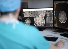 این هوش مصنوعی در 10 ثانیه بخش‌های باقی‌مانده از تومور مغزی را حین جراحی تشخیص می‌دهد