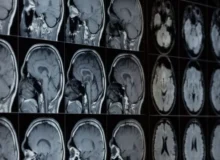 مایکروسافت هوش مصنوعی جدیدی برای تشخیص بیماری‌ها ازجمله سرطان معرفی کرد