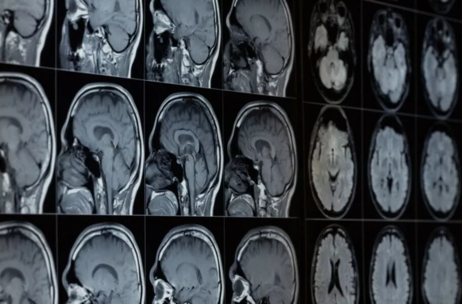 مایکروسافت هوش مصنوعی جدیدی برای تشخیص بیماریها ازجمله سرطان معرفی کرد